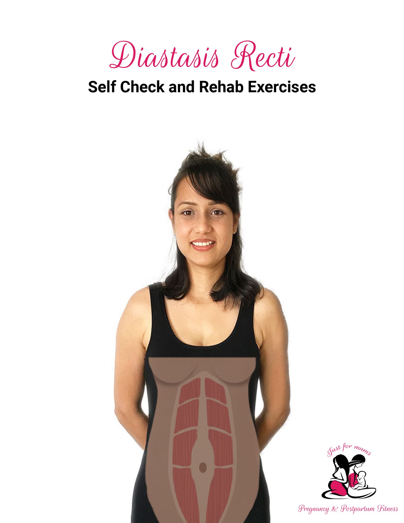 Diastasis-Recti-Guide